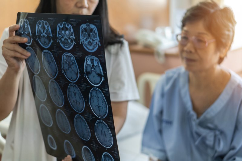 the connection between brain injury and dementia