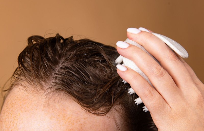 oily scalp
