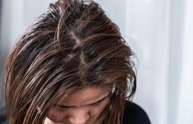 shampoo for oily scalp