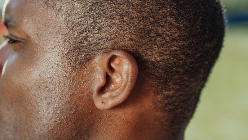 Close-up of a man's hair and scalp, with no visible bumps on scalp.