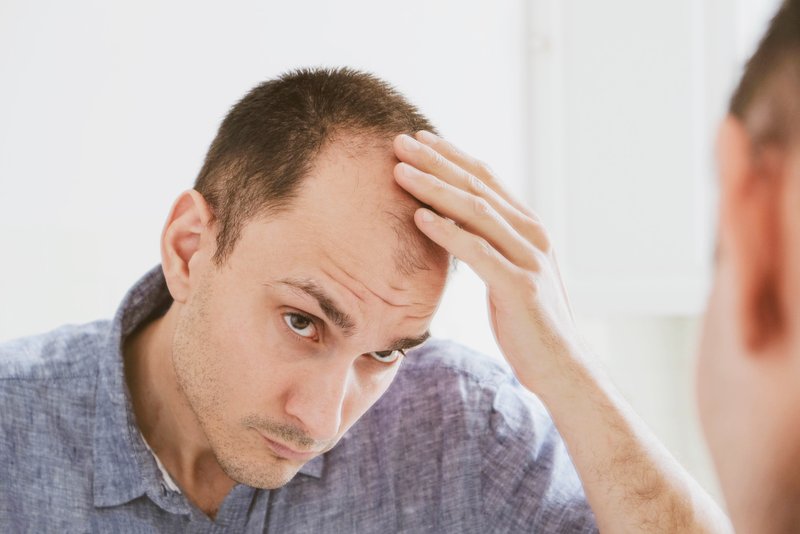someone in need of low-level laser therapy hair loss