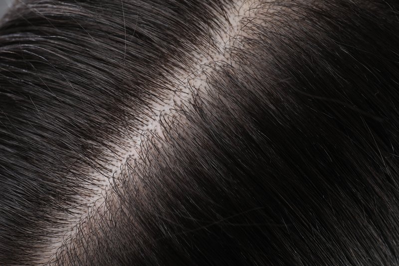 scalp detox treatment for hair loss and itchy scalp
