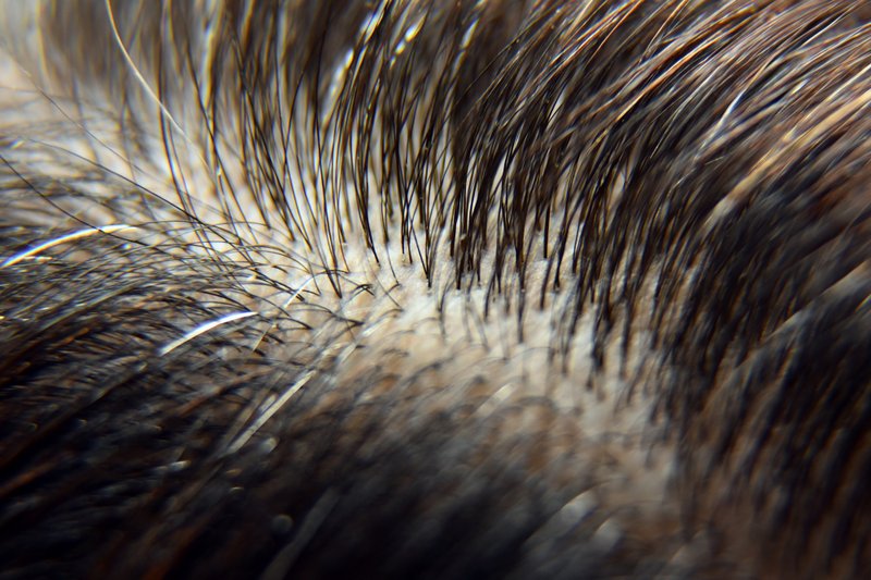 Scalp peeling off in chunks.