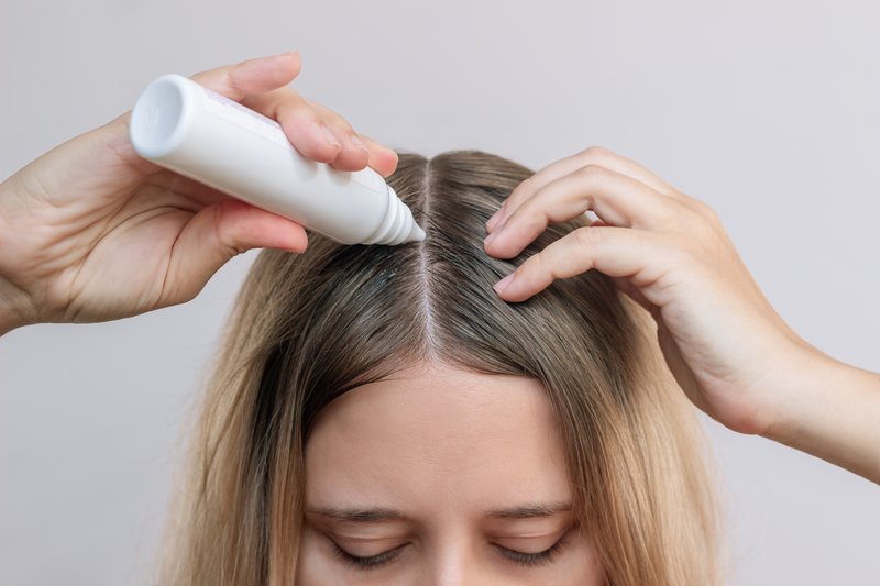 shampoo for oily scalp
