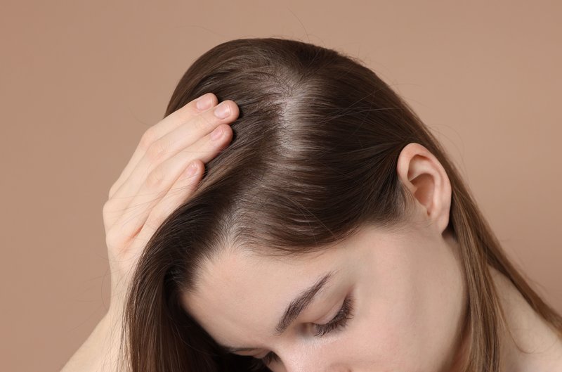 what causes hair loss
