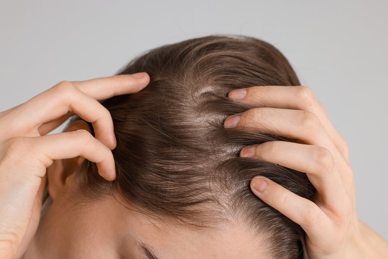 Does Mounjaro Cause Hair Loss?
