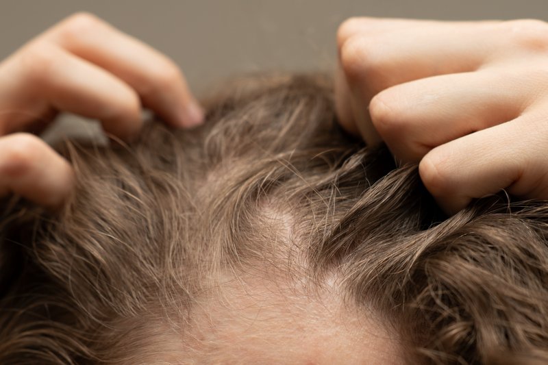 scalp detox treatment to relieve itchiness, hair loss, and dandruff