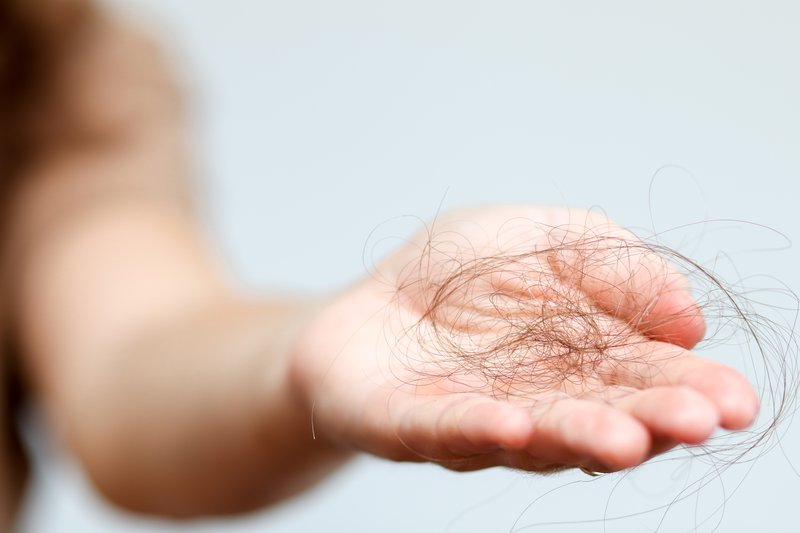 someone in need of red light therapy for hair loss