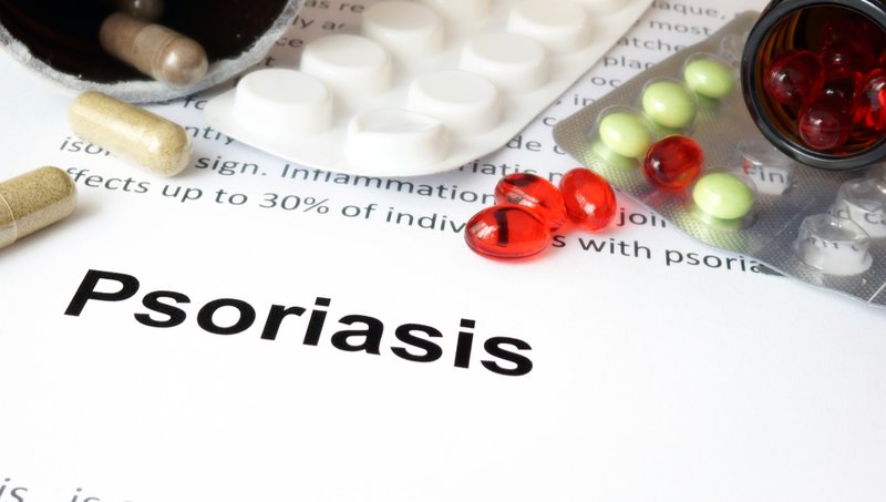 psoriasis treatment