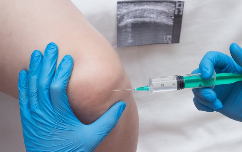 Cortisone shots can provide meaningful short-term relief.