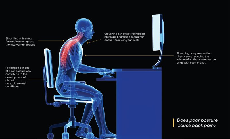 Diagram of issues for slouching tech workers at desk