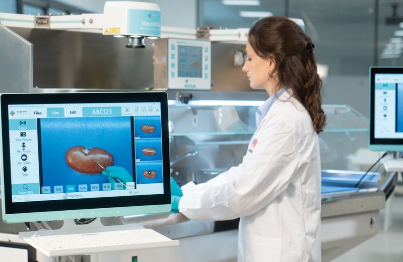 biopsy processing