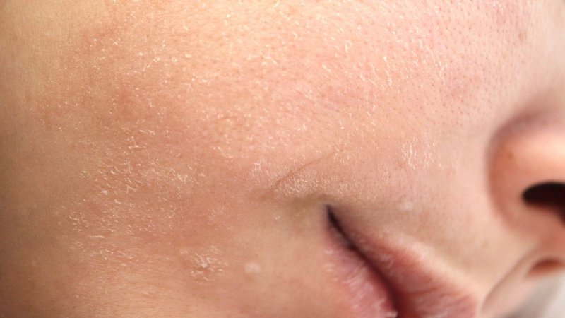 Glycolic Exfoliator